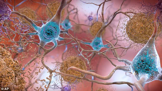 Study Reveals Synergistic Effect of Green Tea Compound and Vitamin B3 in Alzheimer's Research