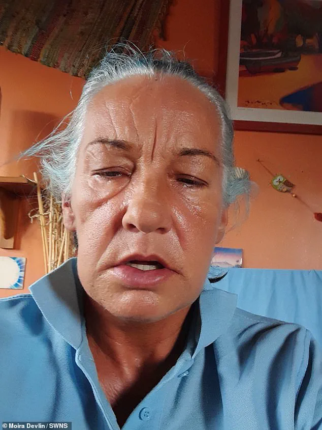 Moira Devlin's £24,000 Dental Implant Alters Appearance, Resembling Fictional Characters and Causing Emotional Turmoil