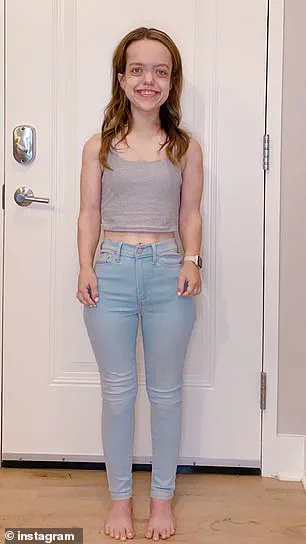 Chandler Crews' Journey with Achondroplasia: Defying Genetic Limits and Redefining Self-Image
