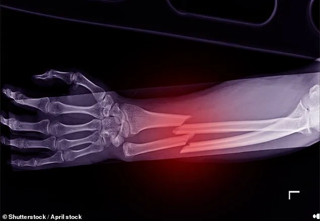 Urgent Call to Action: Delays in Osteoporosis Screening Clinics Risk Women's Lives as 2030 Deadline Looms, Warn Experts