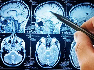 Revolutionizing Mental Health Care: CrossTech's XR Glasses, Funded by UK's Mindset Initiative, Offer New Hope for Dementia and Anxiety Patients