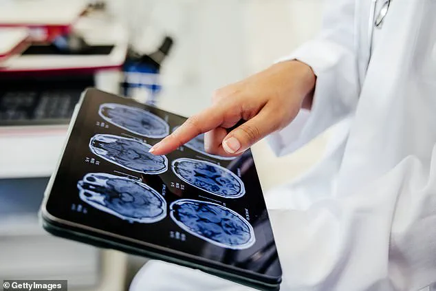 New Study Links 'Temporal Inequality' to Increased Dementia Risk, Highlighting Disparities in Time Availability Across Socioeconomic Classes