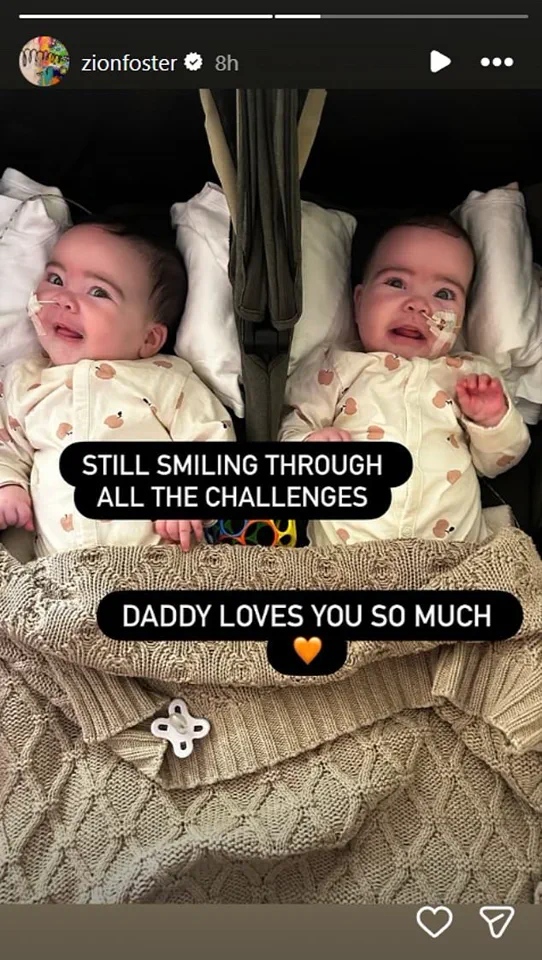 Doctors Applaud Jesy Nelson for Raising Awareness on Rare Muscle Condition Affecting Her Twins