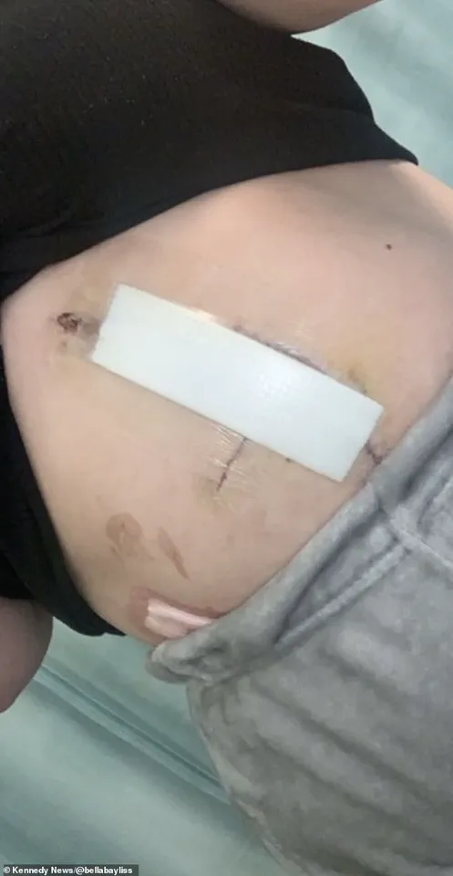 Late-Breaking Update: A&E Failure in Bella Bayliss's Critical Condition