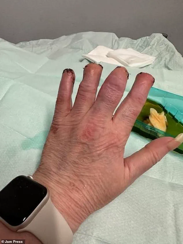 Controversy Over Misdiagnosis Leads to Medical Crisis for Swansea Woman