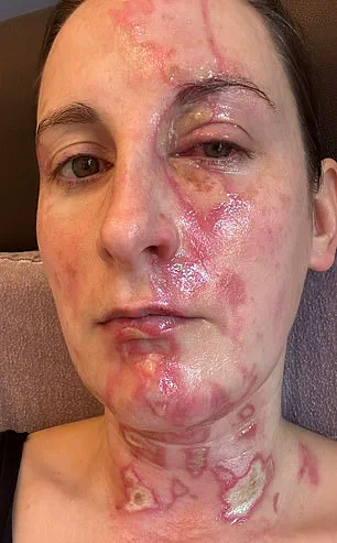 Cecily Beer's Harpist Life Altered by Blender Explosion: 'I Never Imagined This Nightmare'
