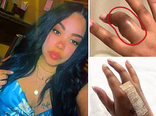 Urgent Warning: Samsung Galaxy Ring Battery Swelling Sparks Hospitalization and Airport Security Incident, Experts Urge Caution