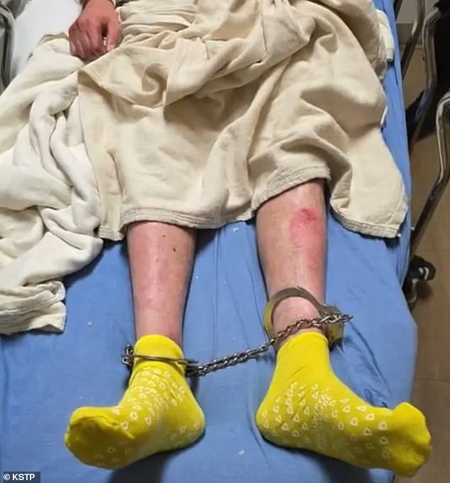 Hani Duklef's Family Warns Deportation to Libya Would Be 'Death Sentence' Due to Rare Genetic Skin Condition, as ICE Detention Sparks Humanitarian Crisis