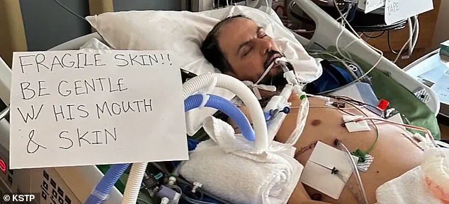 Hani Duklef's Family Warns Deportation to Libya Would Be 'Death Sentence' Due to Rare Genetic Skin Condition, as ICE Detention Sparks Humanitarian Crisis