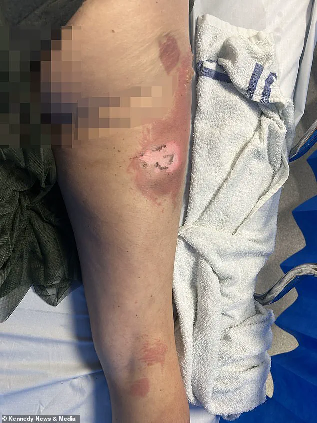 Urgent Safety Alert: Vape Explosion Injures Mother in Essex Car Incident – October 19th Update