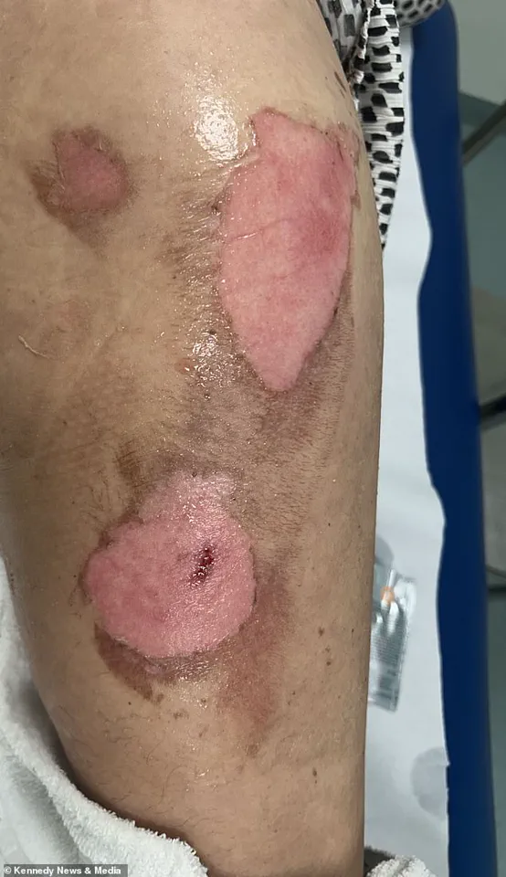 Urgent Safety Alert: Vape Explosion Injures Mother in Essex Car Incident – October 19th Update