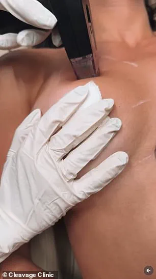Controversial Non-Invasive Breast Enhancements Attract Young Women To New York Clinic