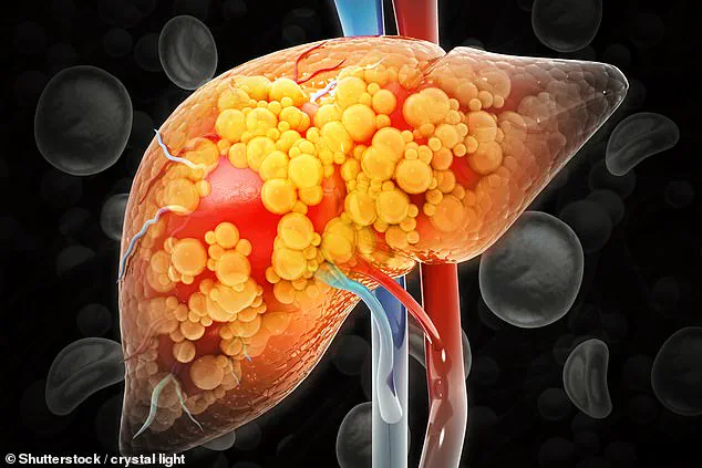 Study Highlights Exercise Benefits in Combating Rising Liver Disease Rates, Prompting Calls for Public Health Policy Reforms