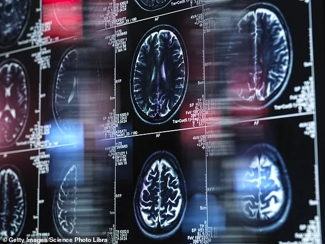 UK Dementia Figures Highlight Growing Public Health Crisis: Over 500,000 Living with Condition, Including 35,000 Under 65