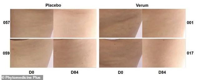 French Maritime Pine Bark Extract Emerges as Effective Cellulite Solution