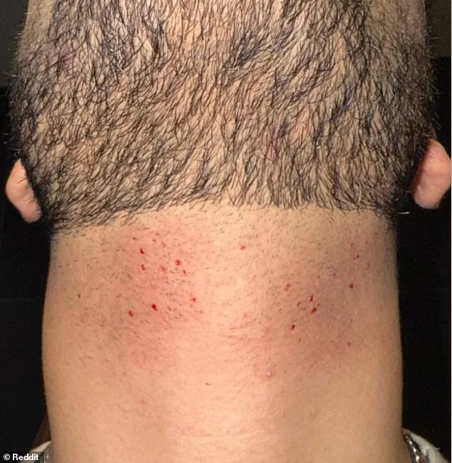 Single-Blade Razors: A Gentle Revolution or a Hidden Risk?