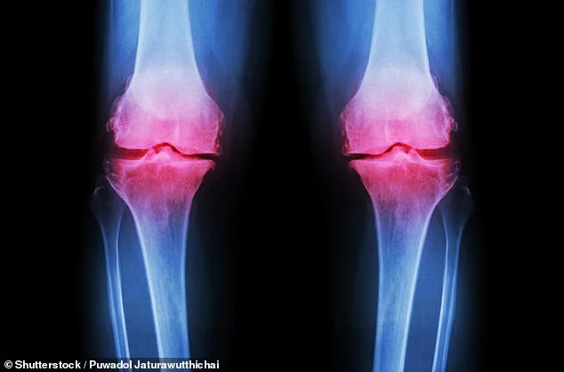 Revolutionary Lab-Grown Knee Offers Permanent Solution to Osteoarthritis
