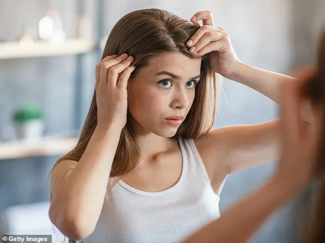 Dandruff Debunked: Yeast, Not Dryness, Is the Real Cause